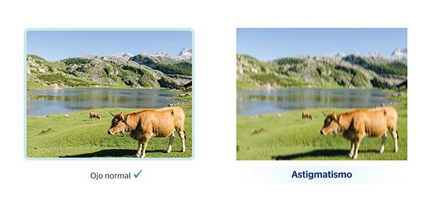 Comparación de visión normal frente a visión con astigmatismo