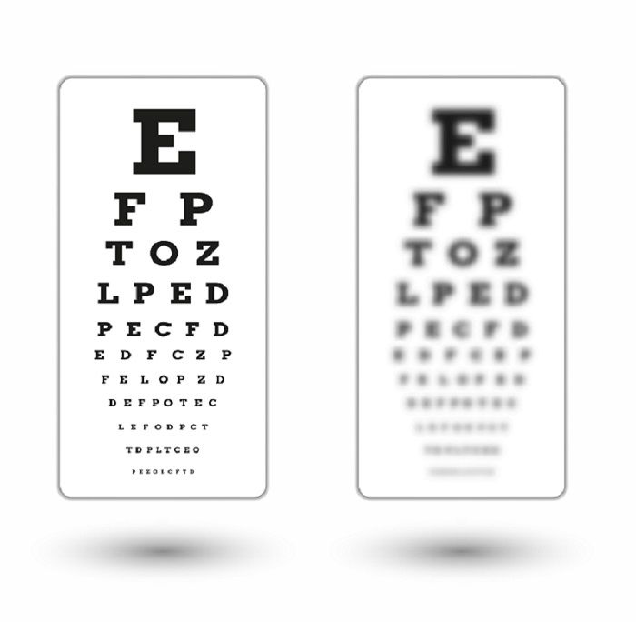 Examen de la vista gratis