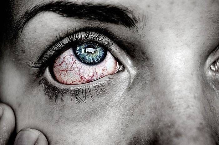Ojos secos y cansados por uso prolongado de computadora